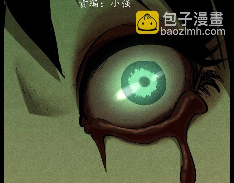 第287话 飞蚊症