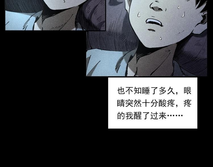 第287话 飞蚊症