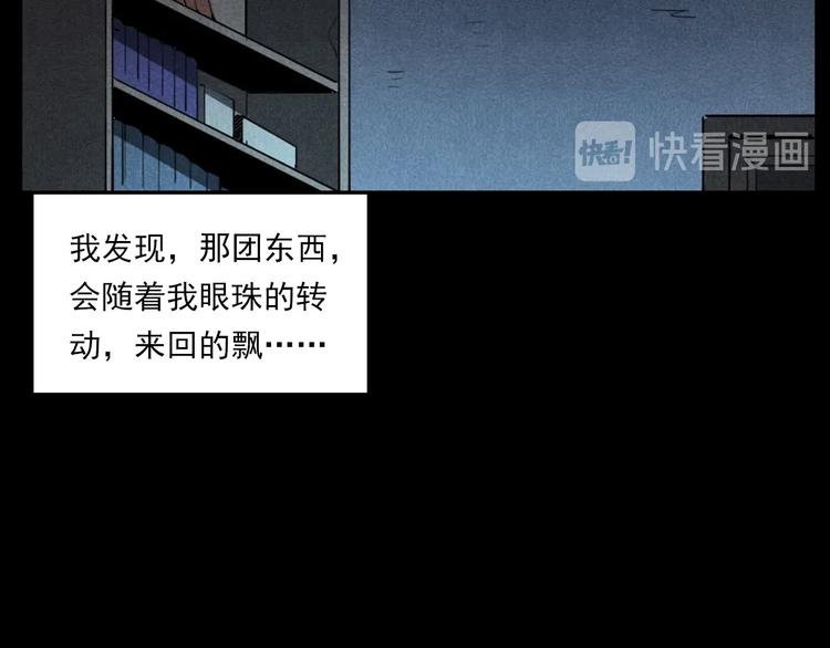第287话 飞蚊症