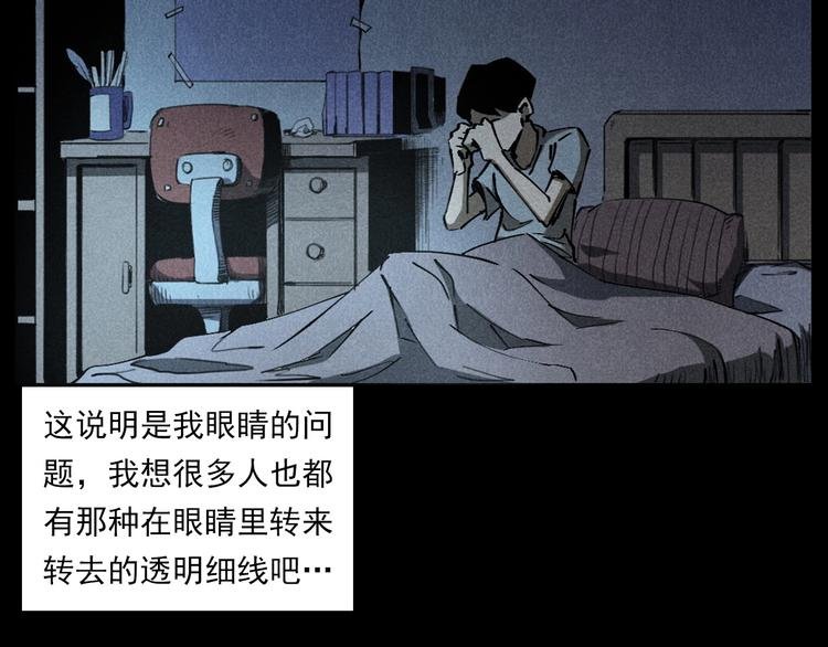 第287话 飞蚊症