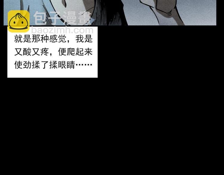 第287话 飞蚊症
