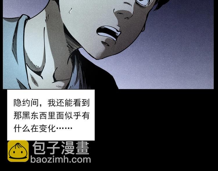 第287话 飞蚊症