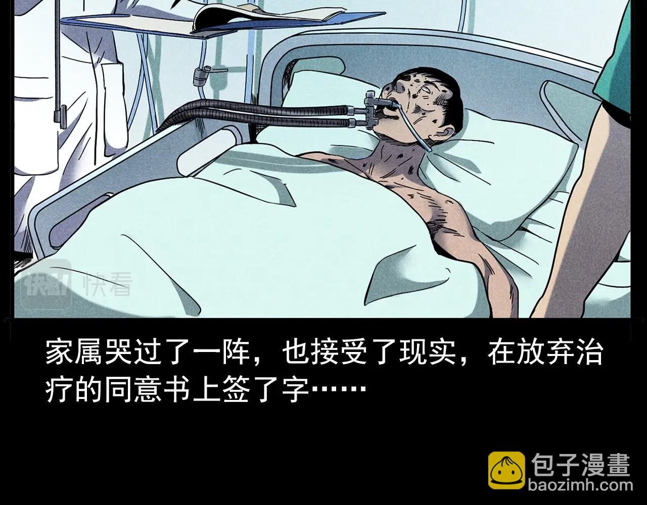 第420话 橘子皮