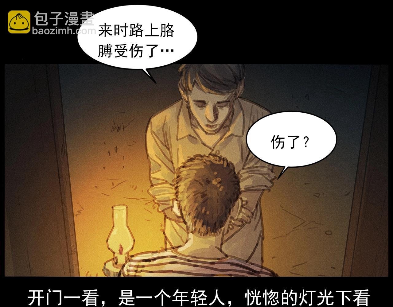 第434话 伤口