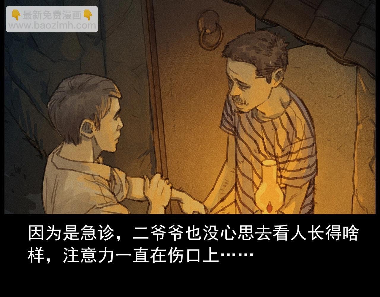 第434话 伤口