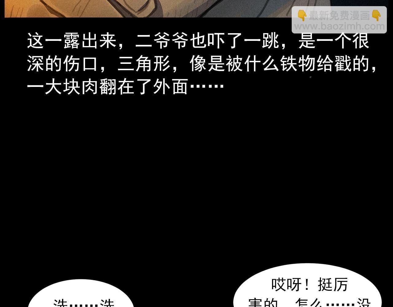 第434话 伤口