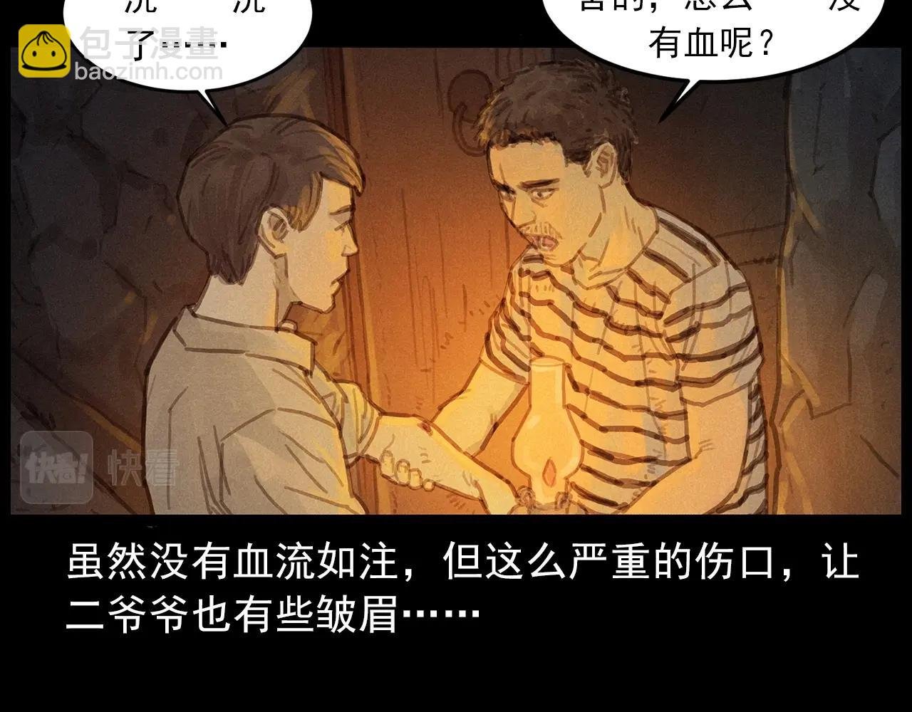 第434话 伤口