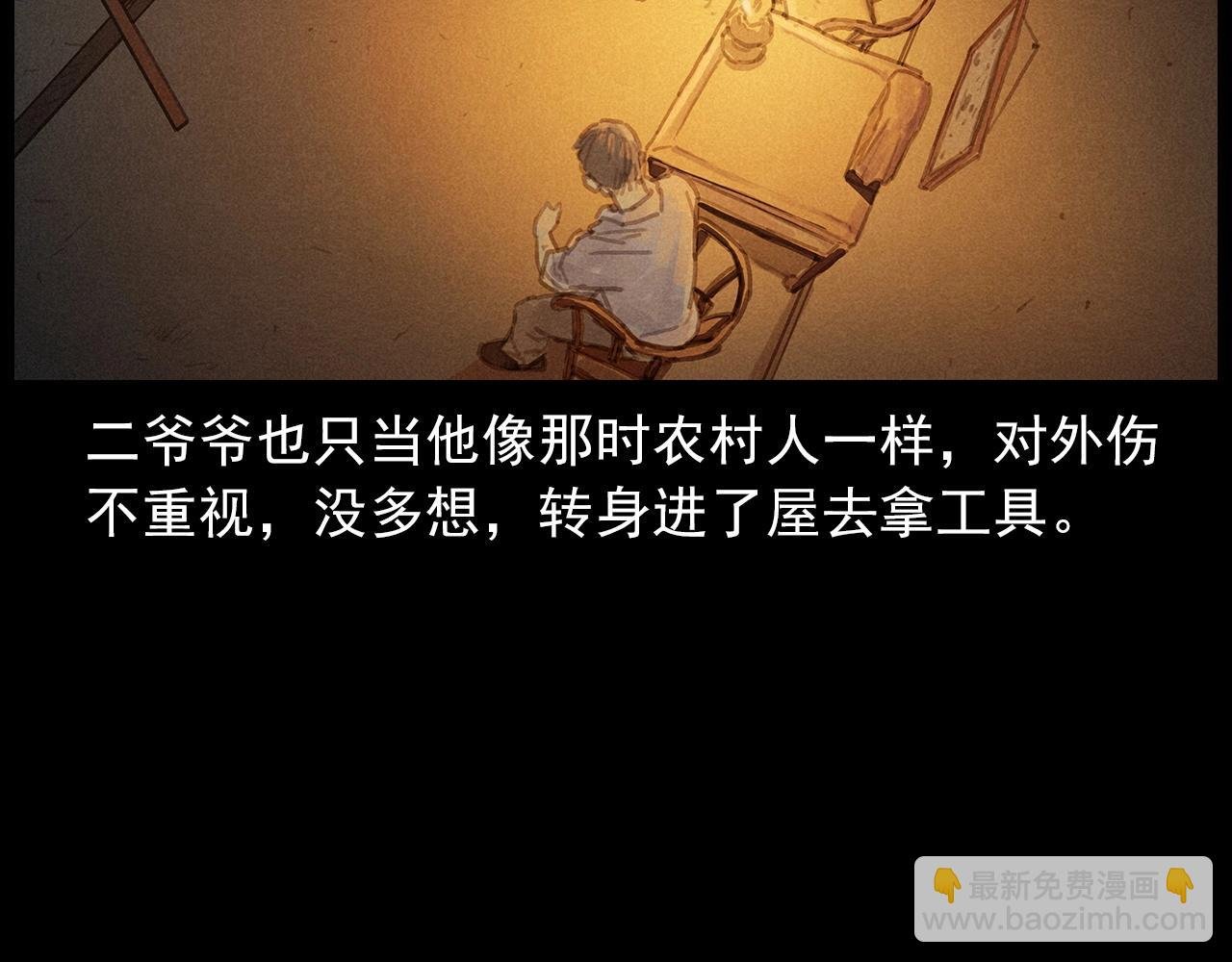 第434话 伤口
