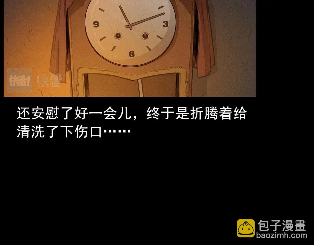 第434话 伤口