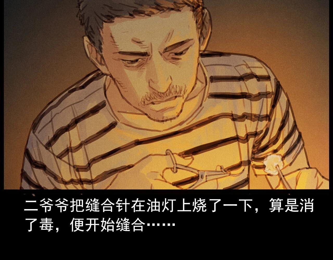 第434话 伤口