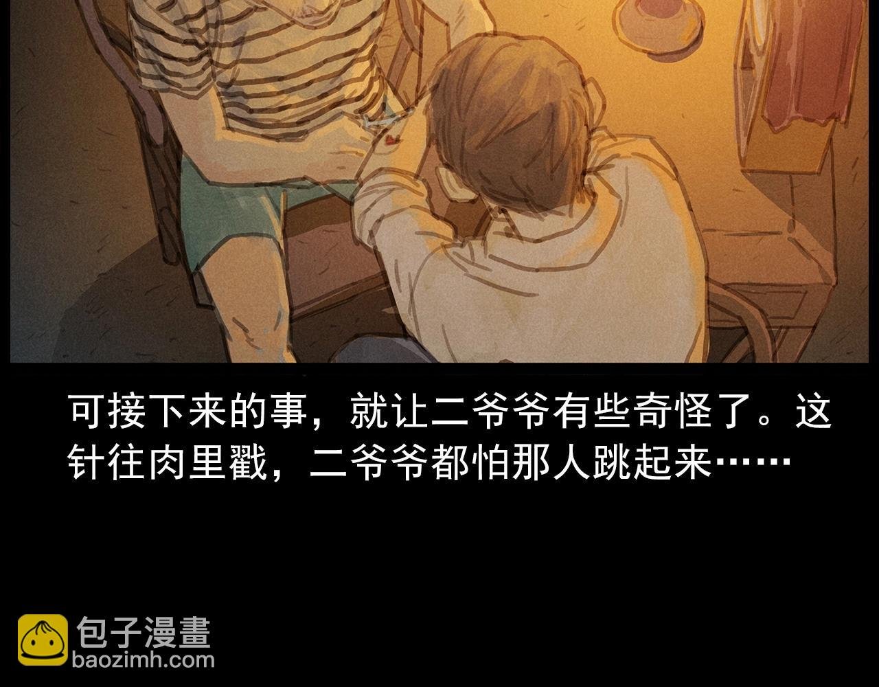 第434话 伤口