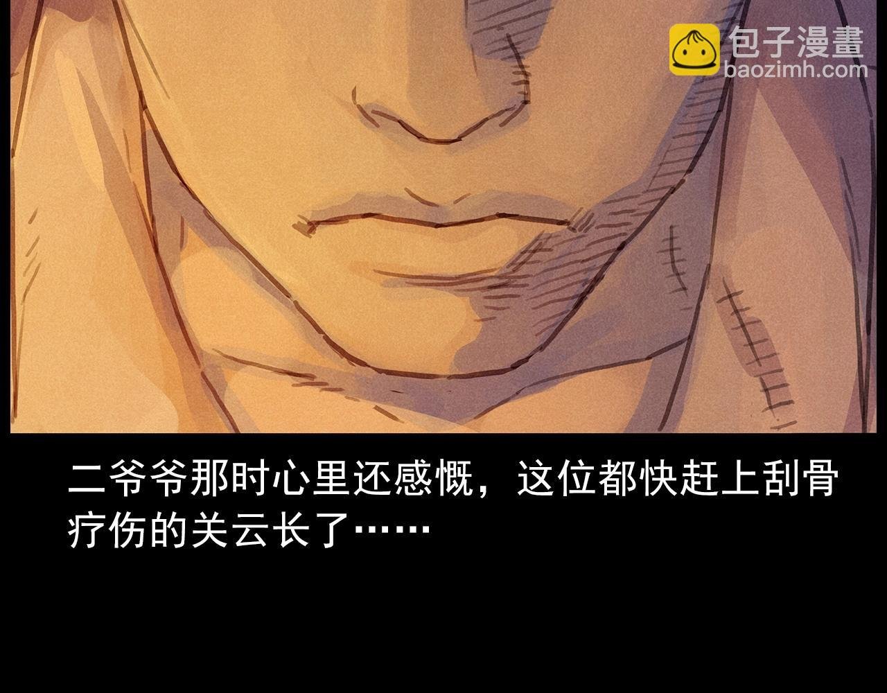 第434话 伤口