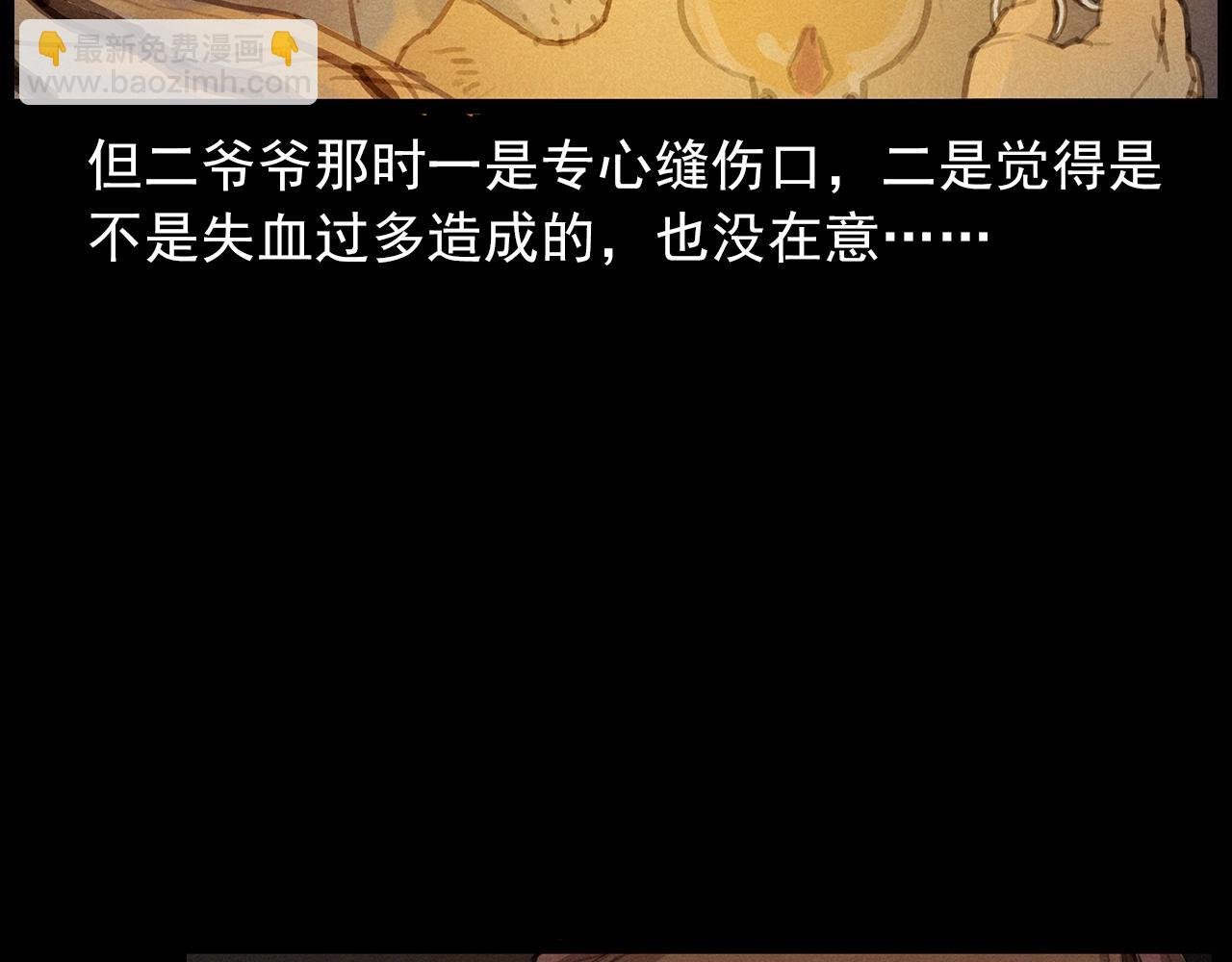 第434话 伤口