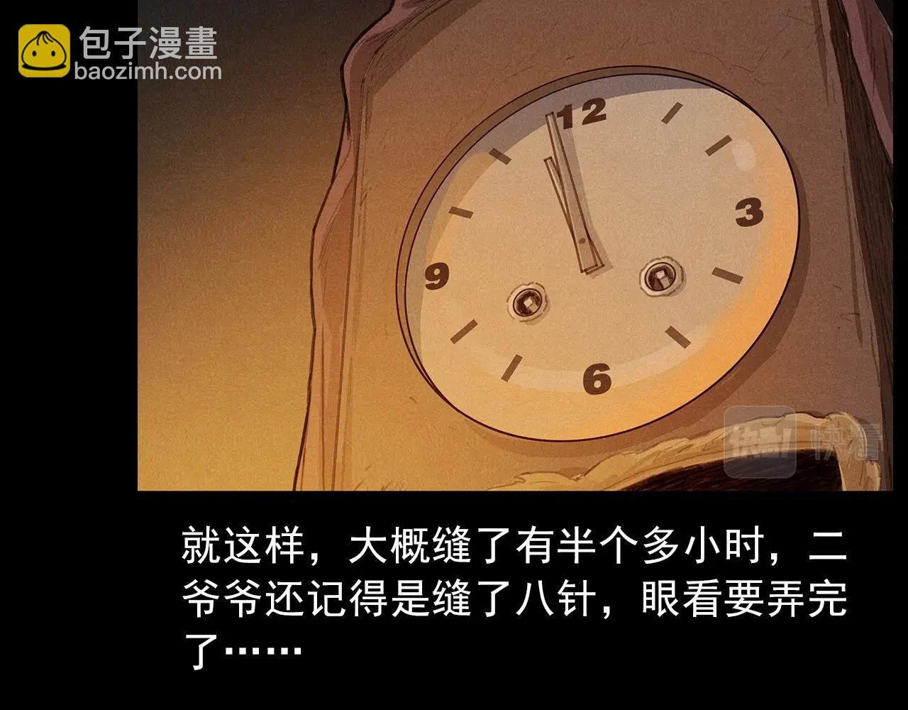 第434话 伤口