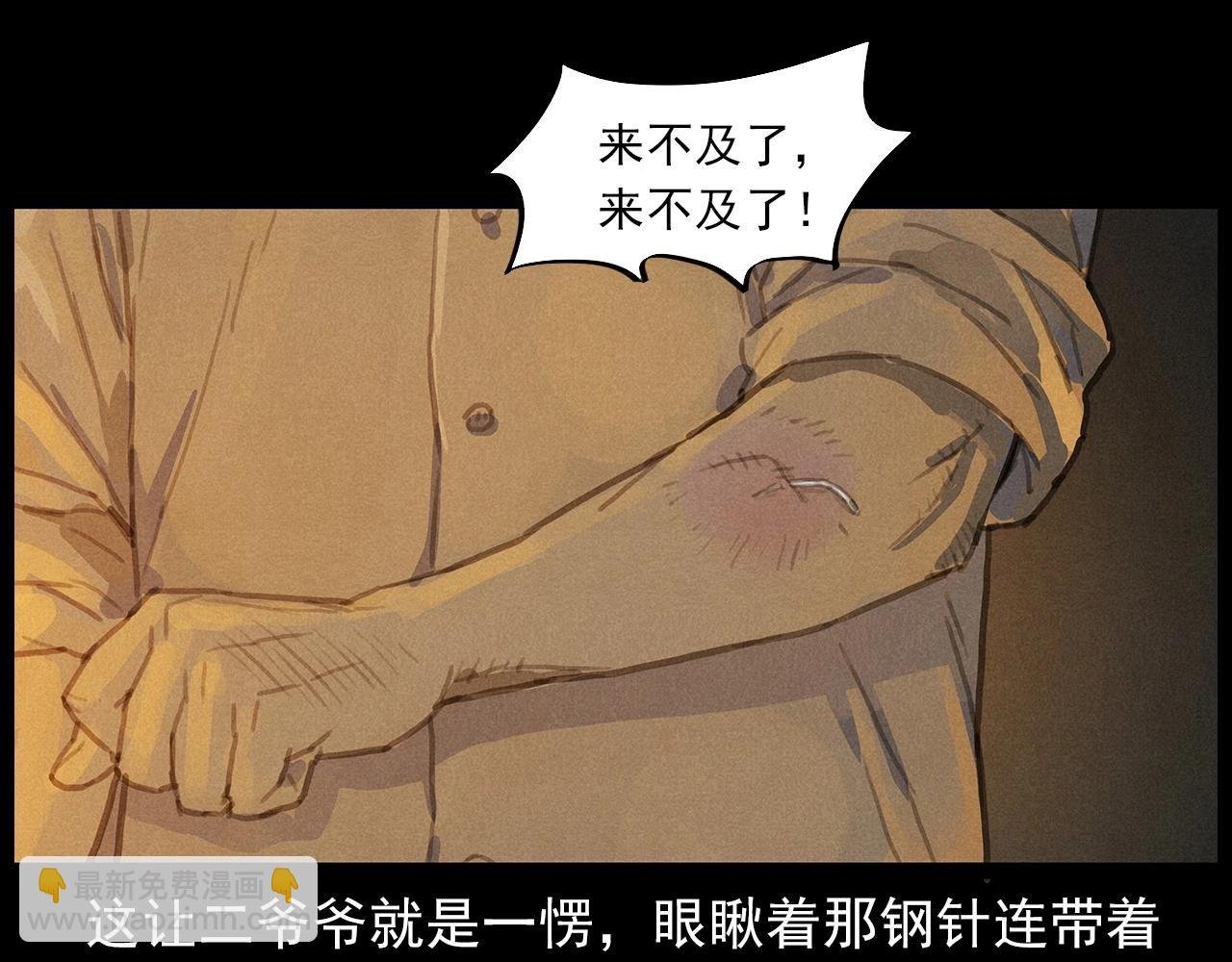 第434话 伤口