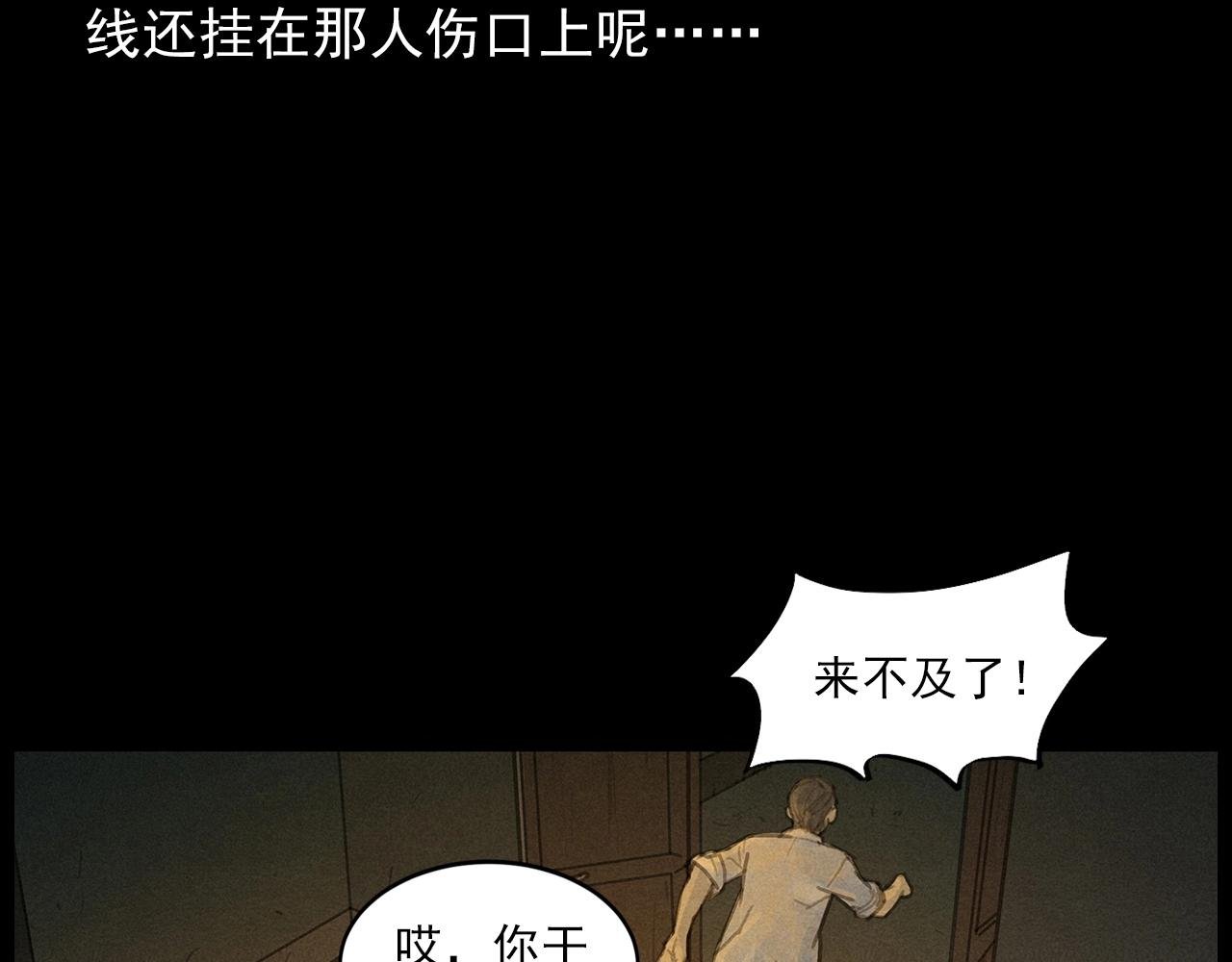 第434话 伤口