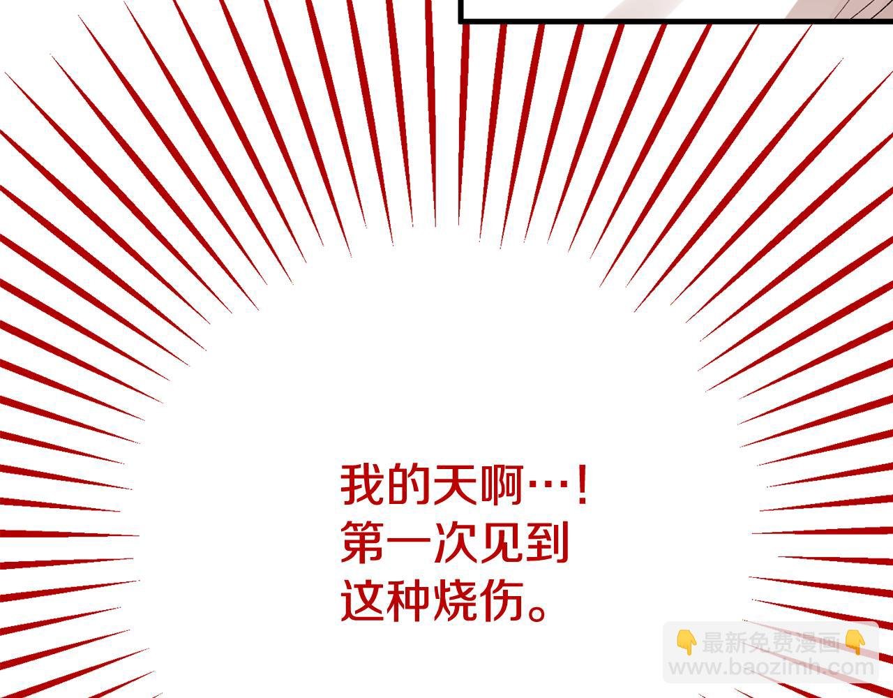 第34话 泽尔突然烧伤