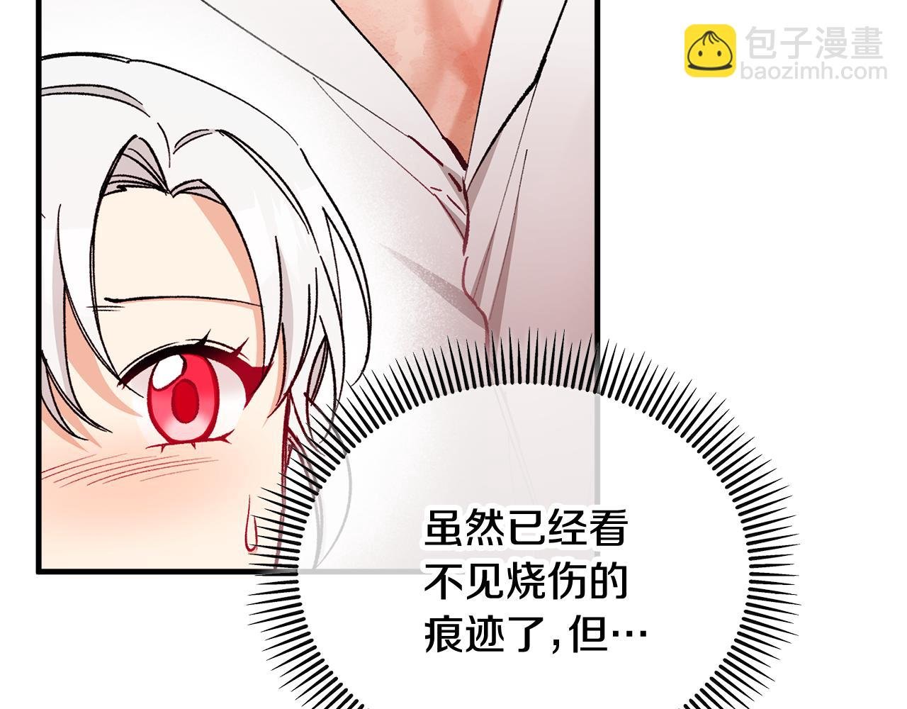 第34话 泽尔突然烧伤