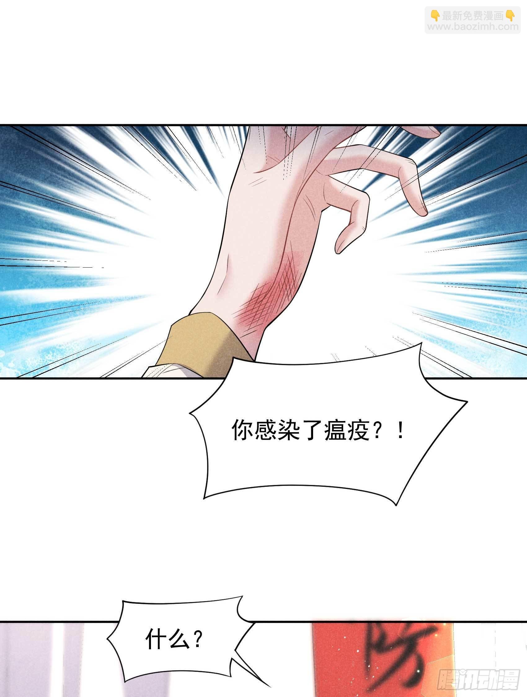 115 锡岚被咬！