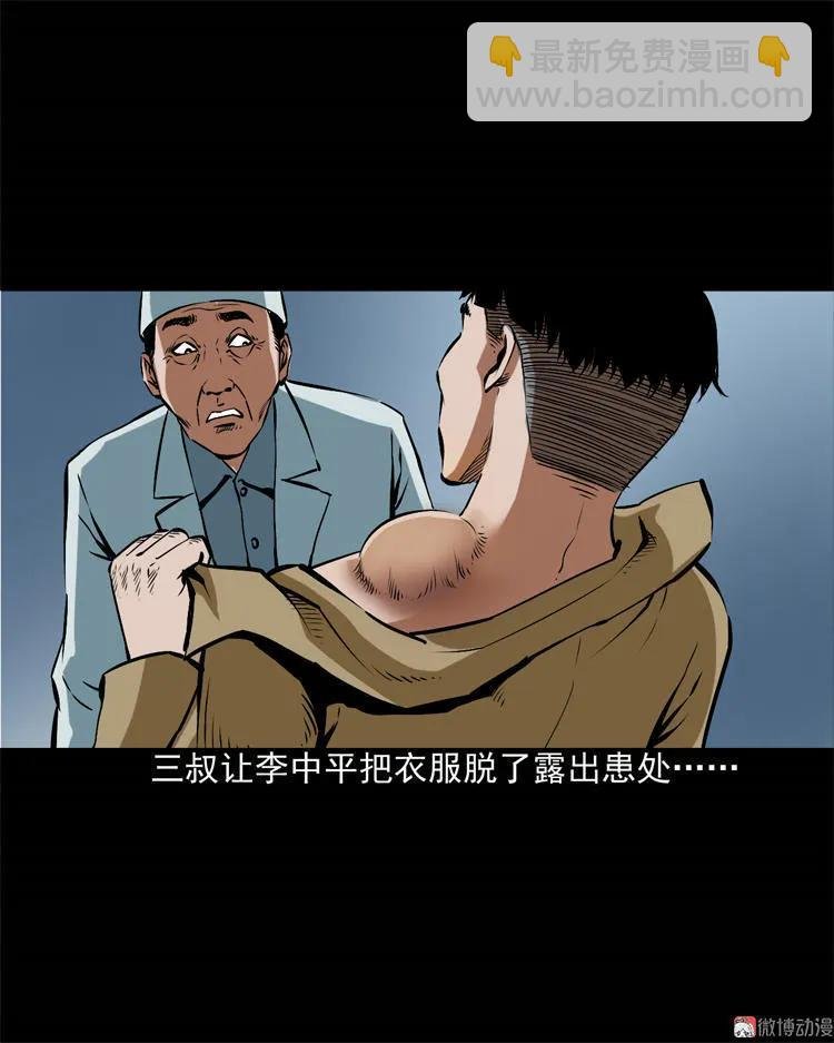 李中平的怪病