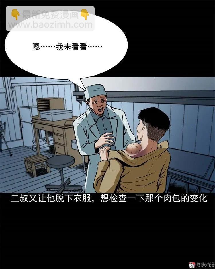 李中平的怪病
