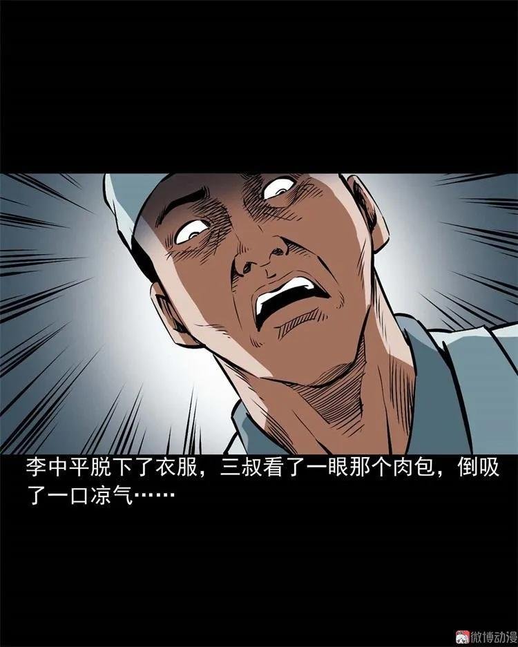 李中平的怪病