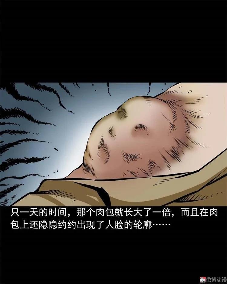 李中平的怪病