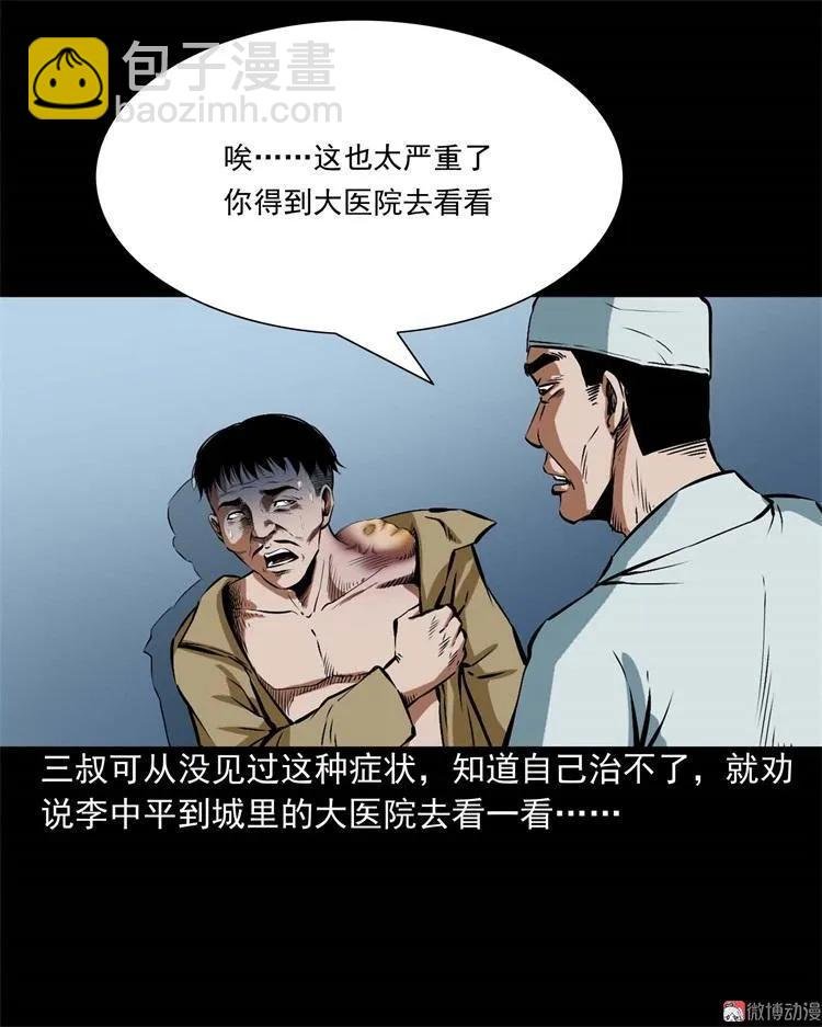 李中平的怪病