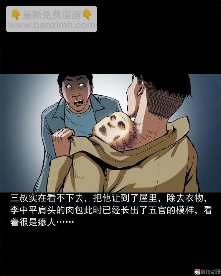 李中平的怪病