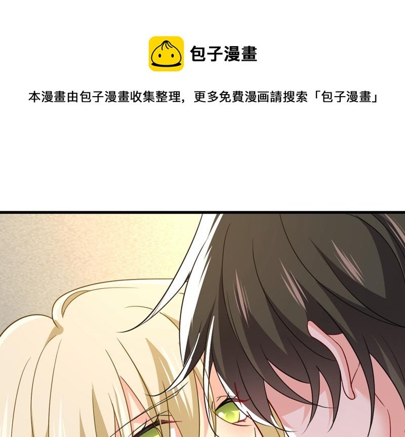 你的手怎么回事？