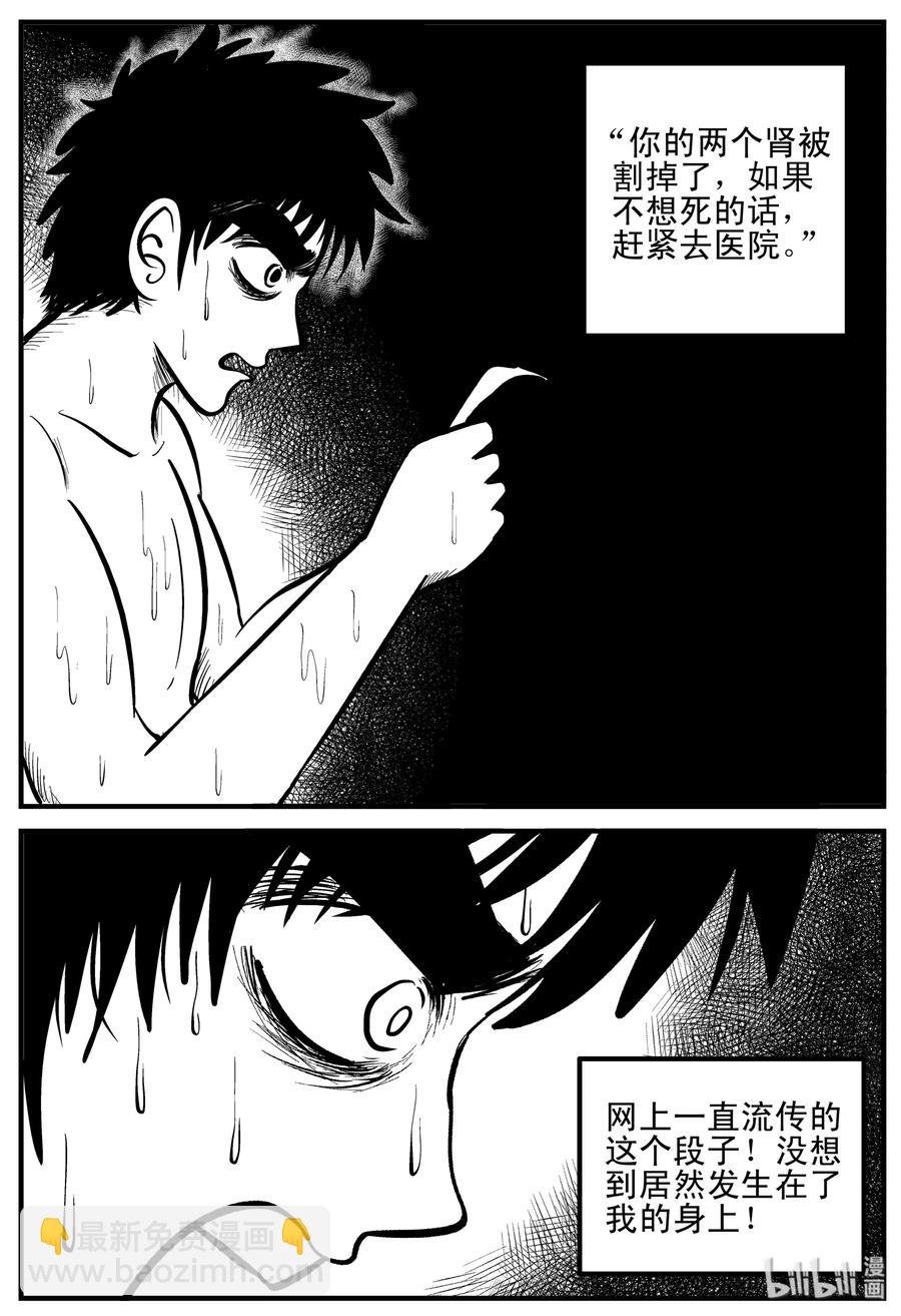 205 谁偷了我的肾（1）