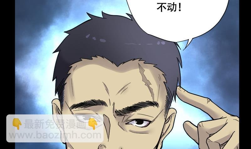 第53话 刺血术 2