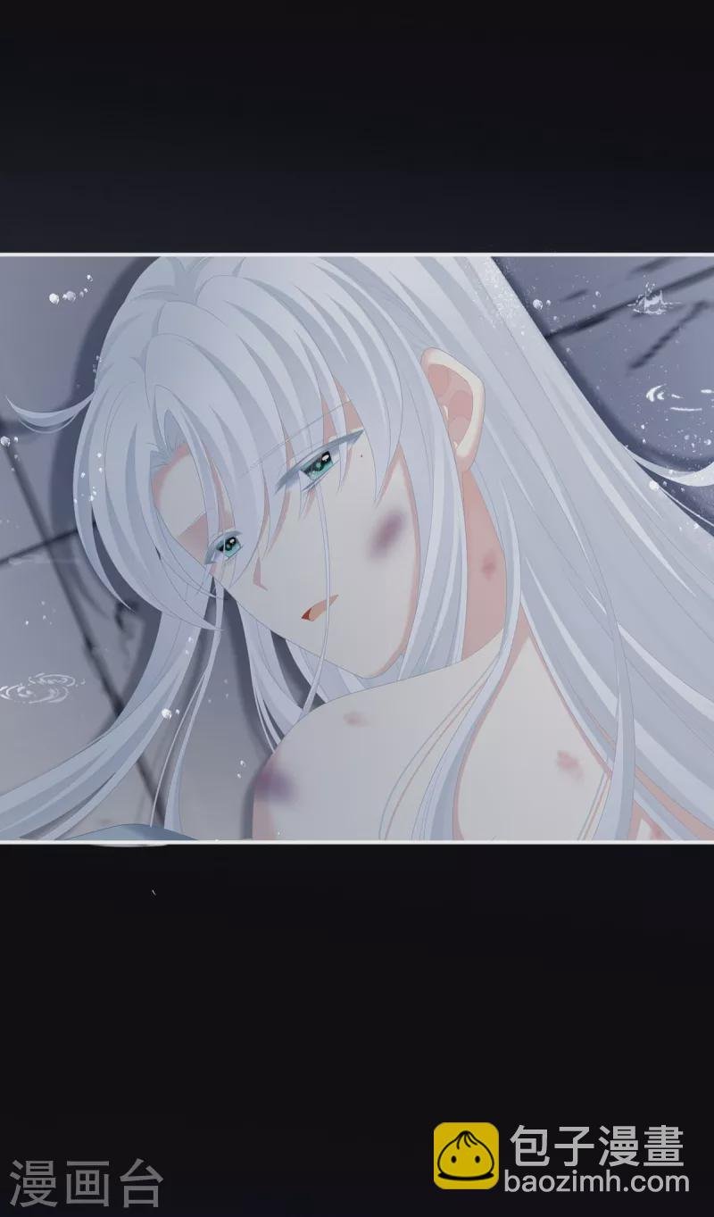 第241话 好痛
