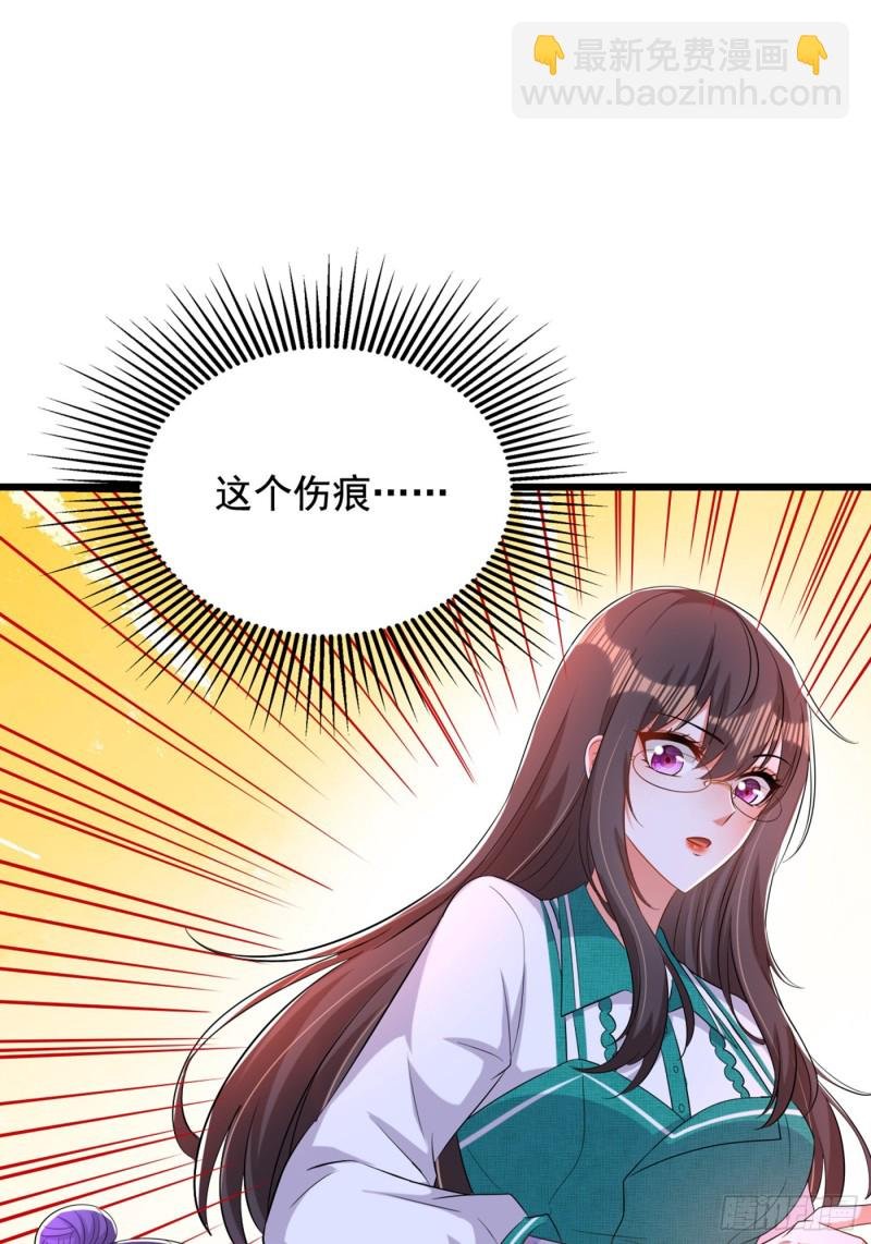 第205话 你手上的伤……