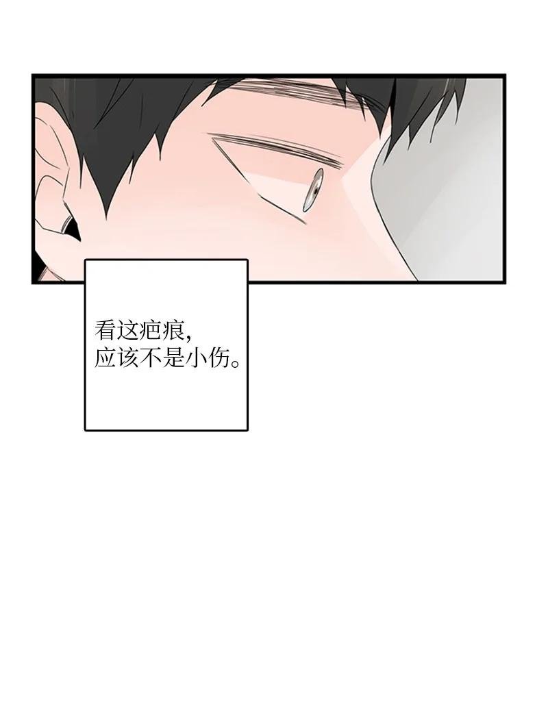 17 是因为那个伤疤吗？