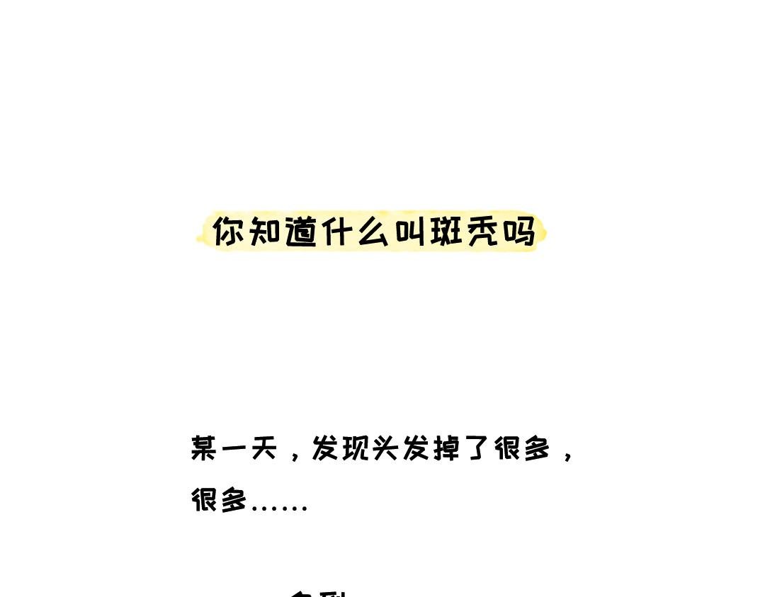 你知道什么叫斑秃吗