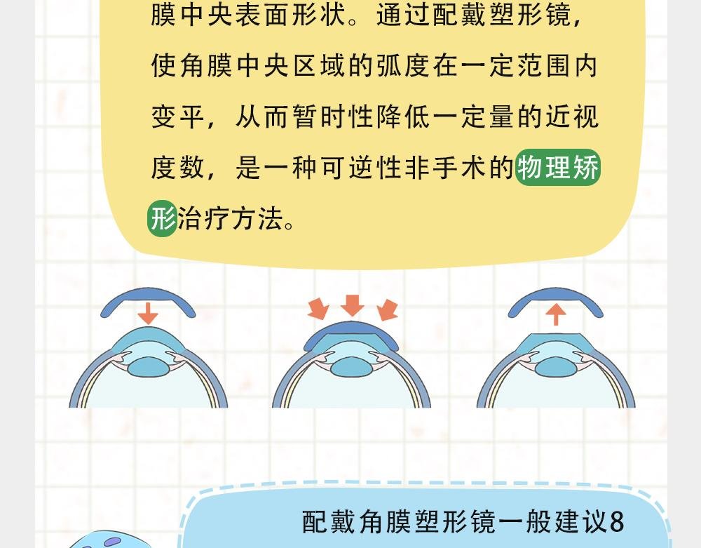 戴框架眼镜的烦恼（下）