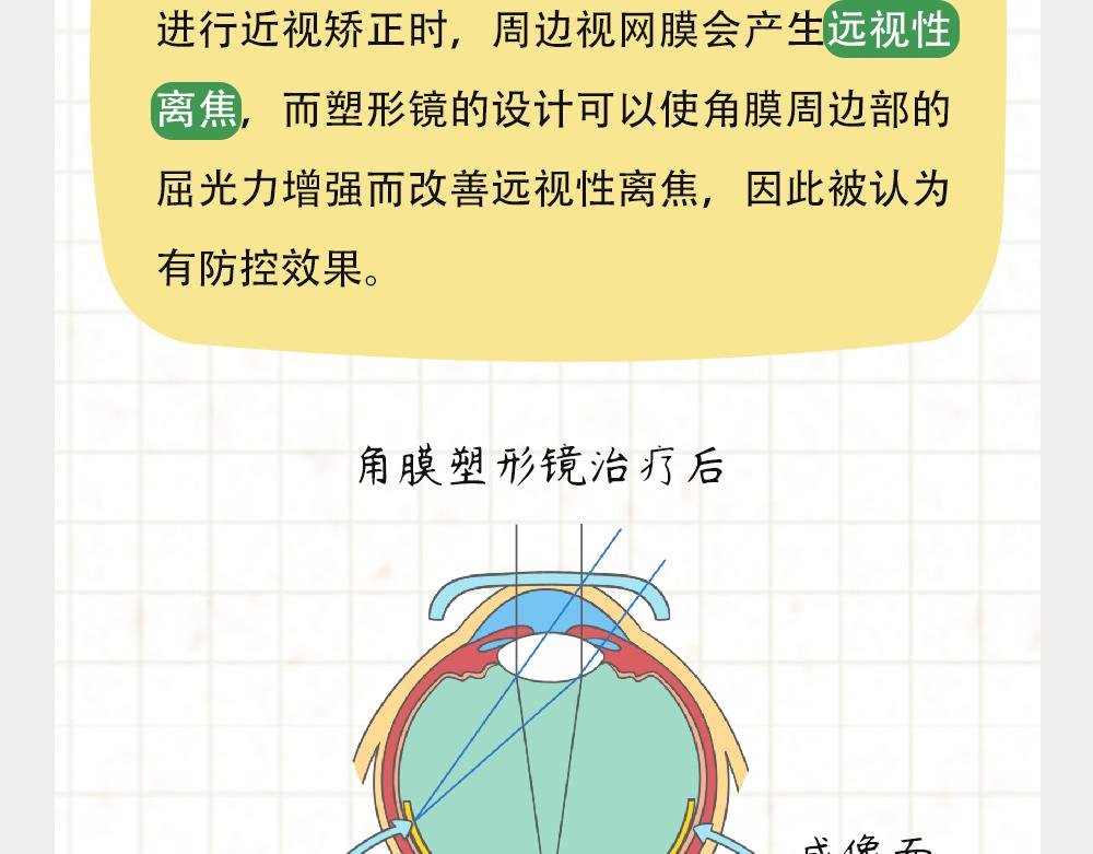 戴框架眼镜的烦恼（下）