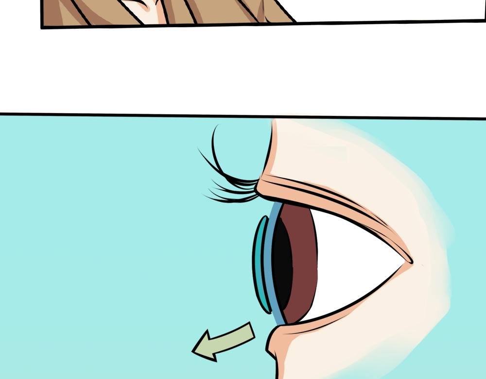 你了解RGP隐形眼镜吗？