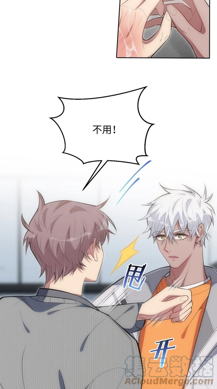 54.烫伤