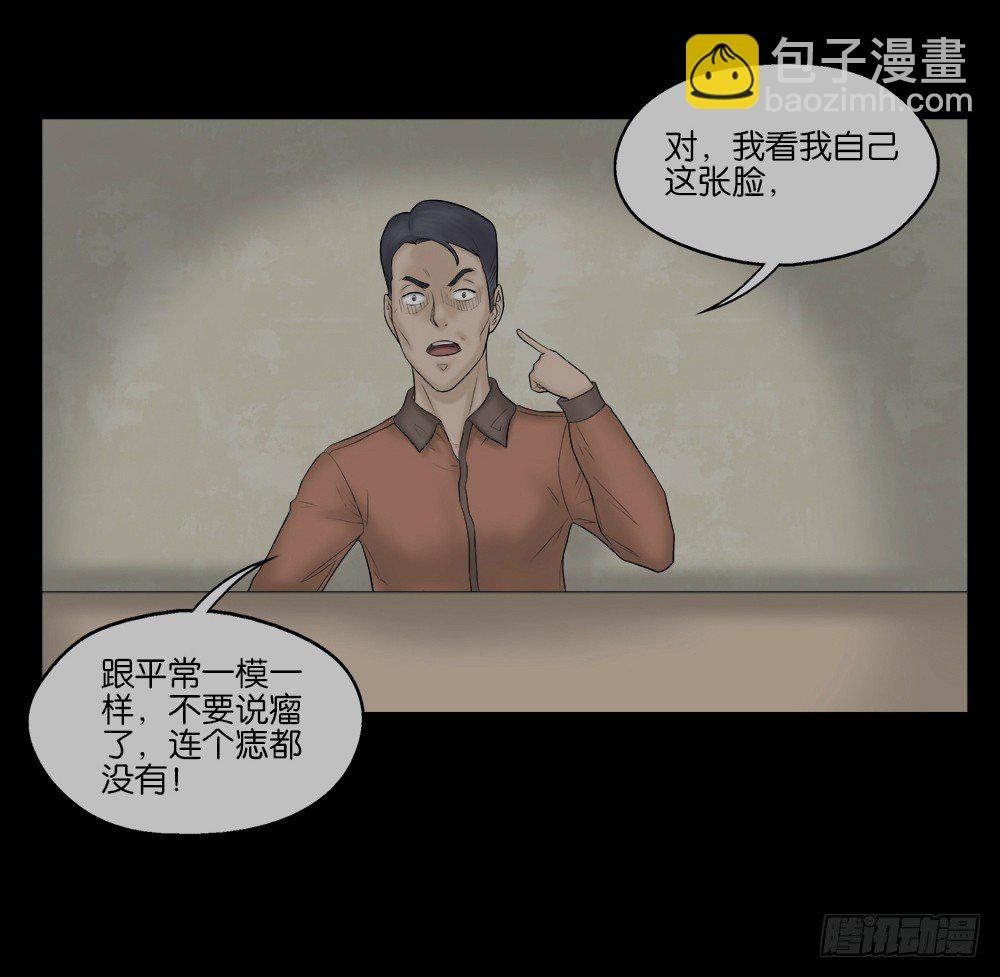 奇异的瘤