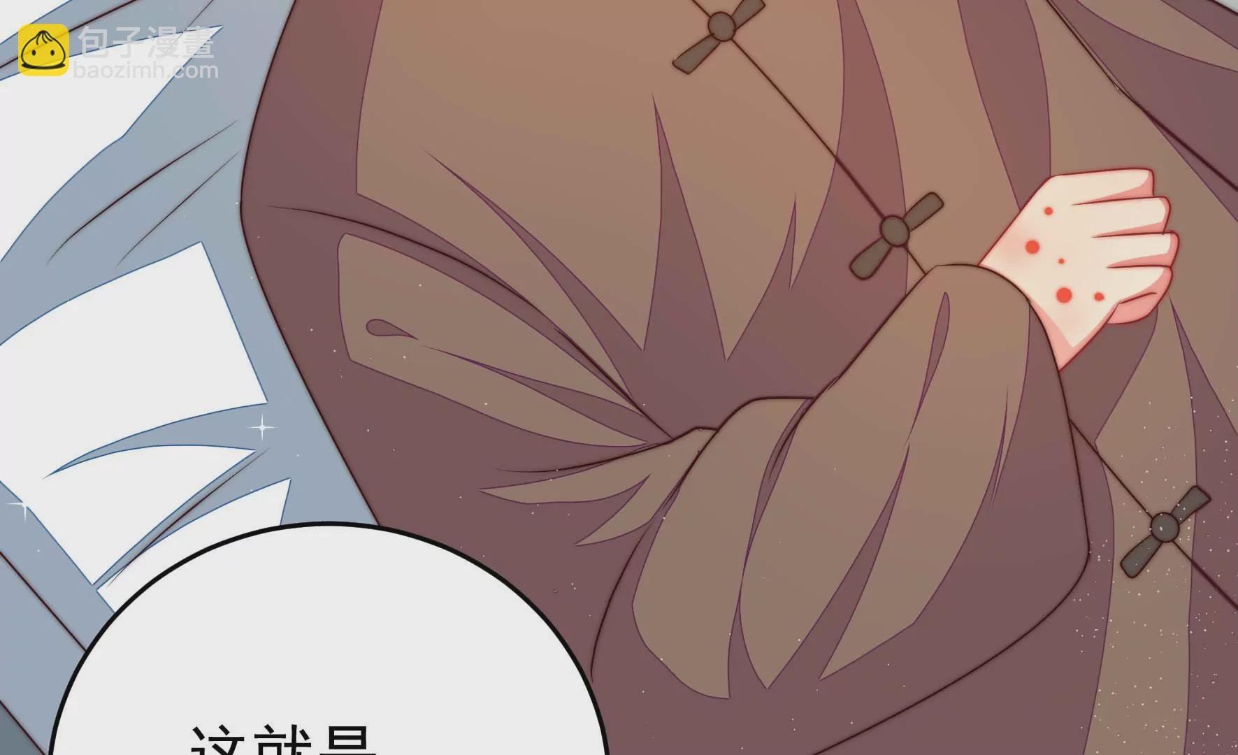 第317话 天花