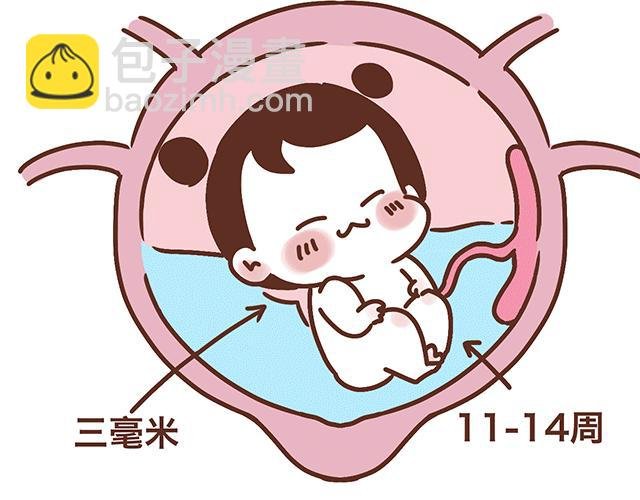 第139话 酱子的产检小知识