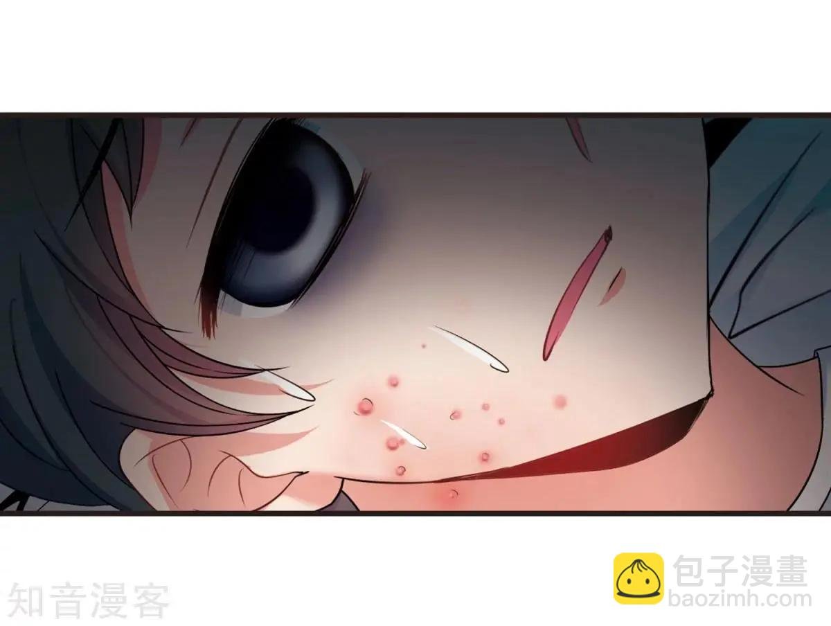 第163话1 疫病流行1