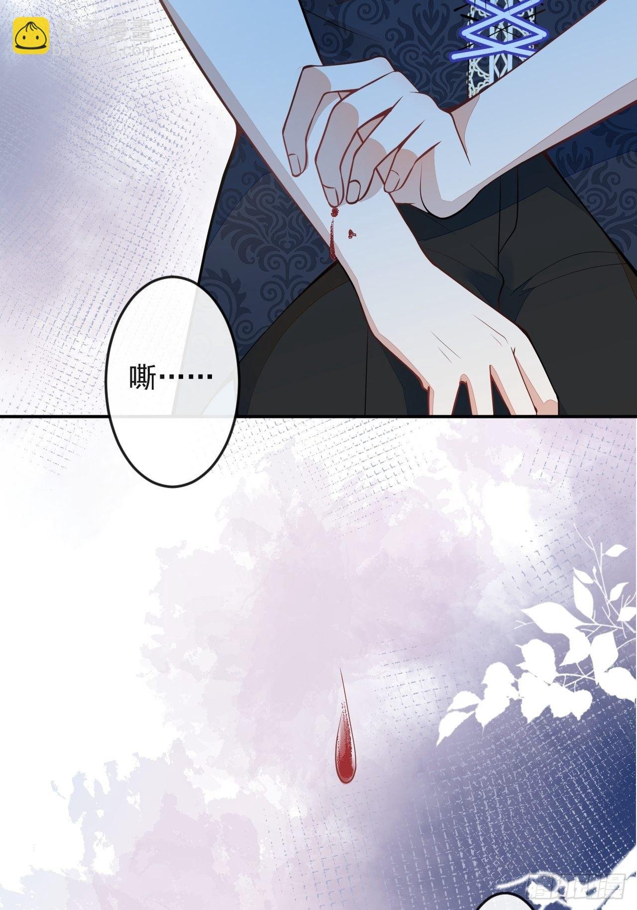 56-夏洛特被蛇咬了