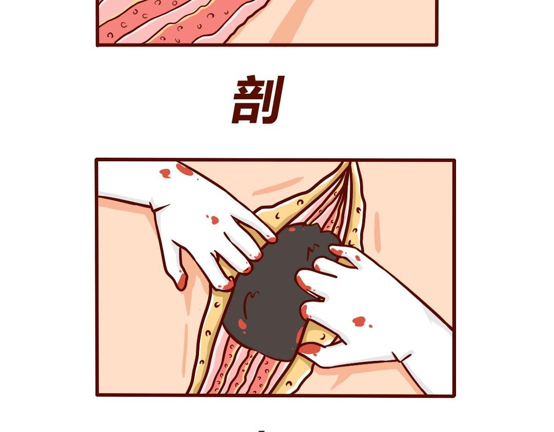 剖腹产生完孩子的6小时