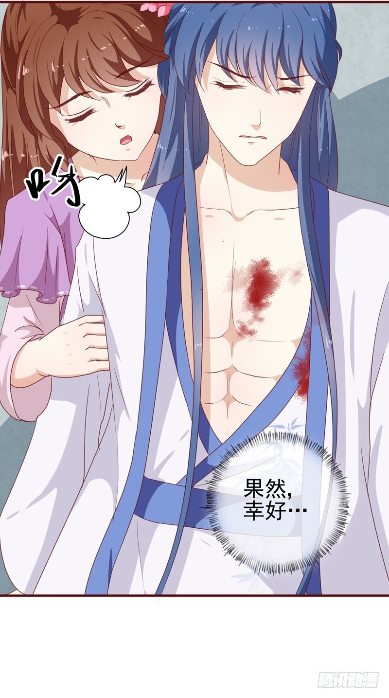 第144话 顾北月受伤