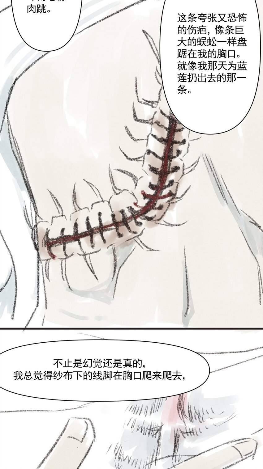 02 第二话 伤疤（中篇）