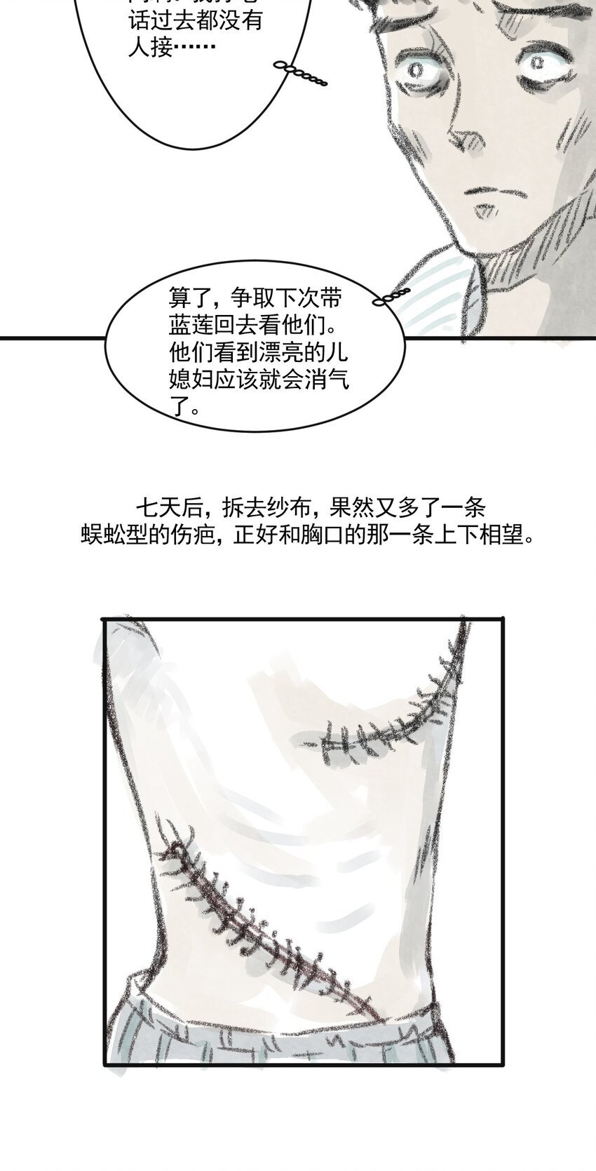02 第二话 伤疤（中篇）