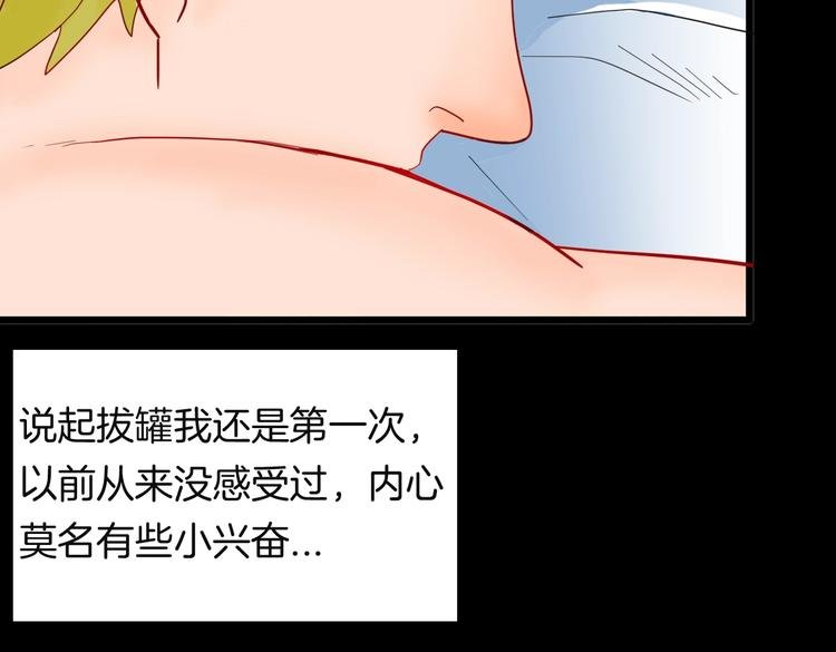 第113话 拔罐